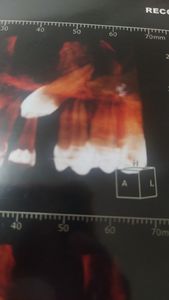 Ribeirão das Neves/MG - Ajude Gabi a sorrir 