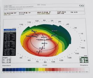 Vaquinha Online - Lentes para o João voltar a enxergar