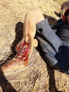 Antônio Teixeira  - Arteriografia - Antônio Teixeira 