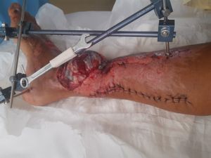 Arteriografia - Antônio Teixeira  imagem 11