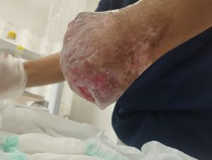 De Volta ao Jogo – Próteses para o Cezinha