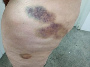 Belo Horizonte/MG - Quero viver