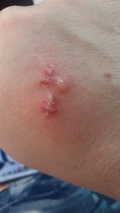 Vaquinha Online - Quero viver