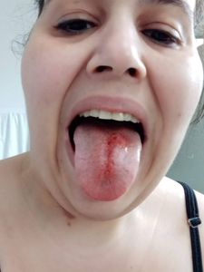 Saúde e Emergências - Quero viver