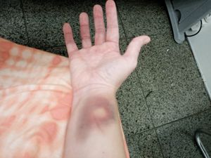 Quero viver - Quero viver