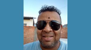 Uma perna Para o Zé