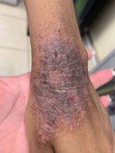 Todos pela Ana - Tratamento médico 