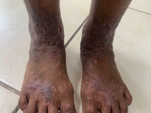 Vaquinha Online - Tratamento médico 