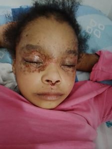 Caieiras/SP - Tratamento médico 