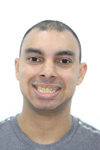 Vaquinha Online - Nasci Com Hipoplasia Grande Nos Dentes