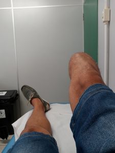 Odair José Mateo Garcia  - Ajudar o Odair a Comprar uma Prótese Transtibial