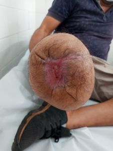 Ajudar o Odair a Comprar uma Prótese Transtibial imagem 9