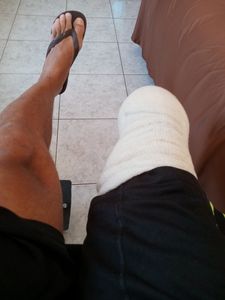 Presidente Prudente/SP - Ajudar o Odair a Comprar uma Prótese Transtibial