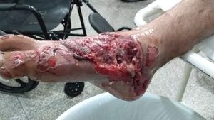 Vaquinha Online - Arrecadação para a cirurgia do pé do Rogério