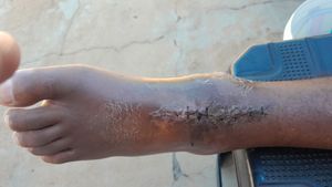 Vaquinha Online - Cirurgia de ressonância 