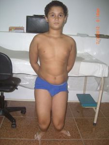 Vaquinha Online - TRATAMENTO PARA HEMIMELIA FIBULAR BILATERAL