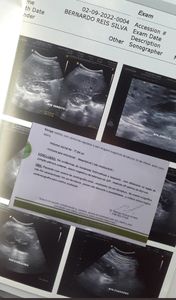 Ajude o bernardo  - #bernardopalmeirense 