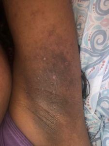 Vaquinha Online - Todos pela Ana Julia 