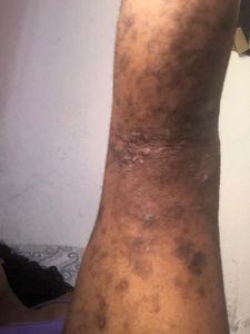 Ana Julia precisa de ajuda e contamos muito com vocês 🙏 - Todos pela Ana Julia 