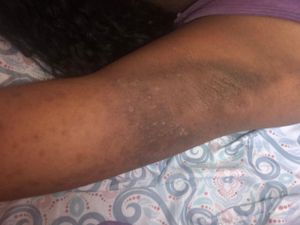 Todos pela Ana Julia  imagem 6