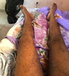 Guarujá/SP - Todos pela Ana Julia 