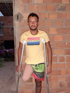 Vaquinha Online - Precisamos da sua ajuda ajude esse pai de família volta andar novamente 