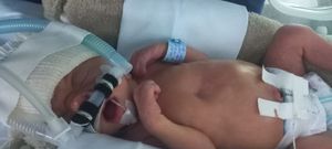 Vaquinha Online - Sindrome rara apert