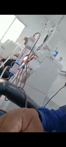 Fístula para hemodiálise  imagem 7