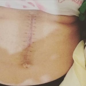 Saúde e Emergências - Tratamento de Câncer