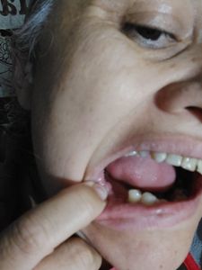 Vaquinha Online - Me ajude a sorrir de volta por favor