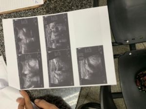 Vaquinha Online - Realizar a cirurgia da apêndice 