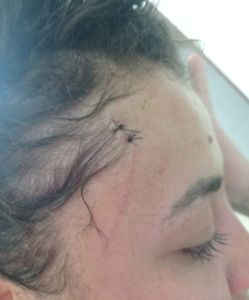 Saúde e Emergências - Cirurgia de emergência 