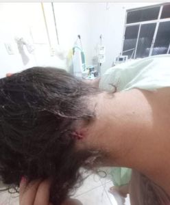 Brigida Maria costa - Cirurgia de emergência 