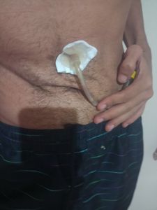 Vaquinha Online - Ajuda cirurgia e dietas enterais 