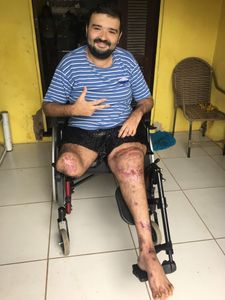 Causas e Comunidade - Adiquirir Handbike para exercitar o corpo e a mente.