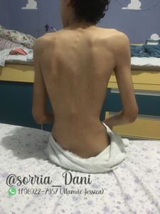 Daniel quer viver! Recursos para o Dani em falência intestinal.  imagem 8