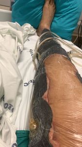 Vaquinha Online - S.O.S Juliano!