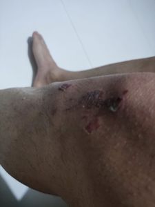 Fui vitima de um acidente e preciso de ajuda para conserta a moto imagem 6