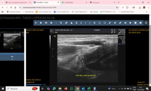 Vaquinha Online - Cirurgia do braço do atleta  Tiago Silva