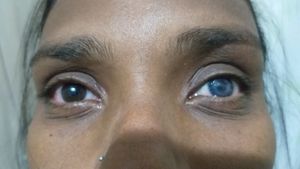 Saúde e Emergências - Visão é vida!!!