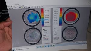 Vaquinha Online - Visão é vida!!!