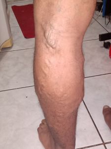 Cirurgia urgente de Renan Graciano imagem 6