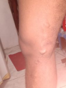 Vaquinha - Cirurgia urgente de Renan Graciano