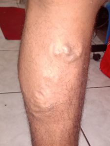 Cirurgia urgente de Renan Graciano - Cirurgia urgente de Renan Graciano