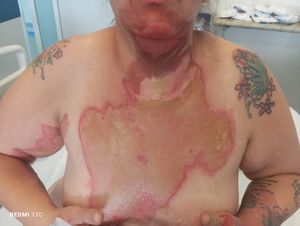 Francisco Morato/SP - Me ajudem com os custos do tratamento do meu acidente e com meus filhos!!!!