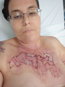 Me ajudem com os custos do tratamento do meu acidente e com meus filhos!!!!