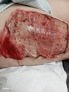 Me ajudem com os custos do tratamento do meu acidente e com meus filhos!!!! imagem 6