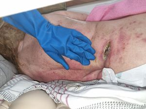 Crowdfunding - Ajuda para minha avó Nanci!