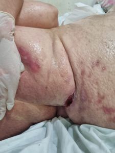 Saúde e Emergências - Ajuda para minha avó Nanci!