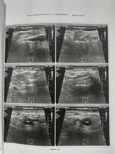 Maria  de Nazaré Andrade  - Cirurgia da Dona Maria 